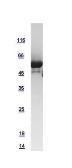Human mLST8 / GBL protein, GST tag. GTX108631-pro