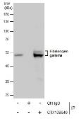 Anti-Fibrinogen gamma antibody used in Immunoprecipitation (IP). GTX108640
