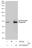 Anti-Fibrinogen gamma antibody used in Immunoprecipitation (IP). GTX108640