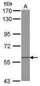 Anti-ZNF350 antibody used in Western Blot (WB). GTX108644