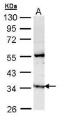 Anti-GIMAP5 antibody used in Western Blot (WB). GTX108652