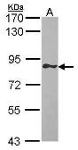 Anti-GIMAP8 antibody [C1], Internal used in Western Blot (WB). GTX108654