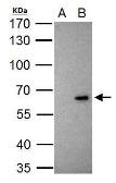 Anti-KLF10 antibody used in Immunoprecipitation (IP). GTX108661