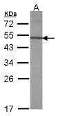 Anti-KLF10 antibody used in Western Blot (WB). GTX108662