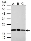 Anti-DCTD antibody used in Western Blot (WB). GTX108663