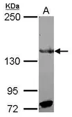 Anti-RFX1 antibody used in Western Blot (WB). GTX108664