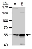 Anti-TdT antibody [C1C3] used in Western Blot (WB). GTX108697