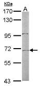 Anti-TR2 antibody [N1N3] used in Western Blot (WB). GTX108704