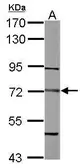 Anti-Dystrobrevin beta antibody used in Western Blot (WB). GTX108710