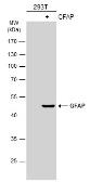Anti-GFAP antibody used in Western Blot (WB). GTX108711