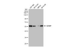 Anti-GFAP antibody used in Western Blot (WB). GTX108711