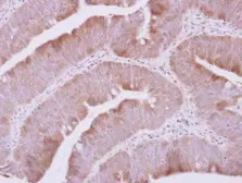Anti-QARS antibody [N3C2], Internal used in IHC (Paraffin sections) (IHC-P). GTX108713
