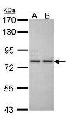 Anti-ALS antibody [C1C3-2] used in Western Blot (WB). GTX108718