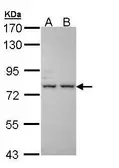 Anti-ALS antibody [C1C3-2] used in Western Blot (WB). GTX108718