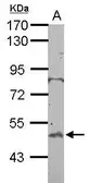 Anti-BTBD10 antibody [N3C3] used in Western Blot (WB). GTX108739