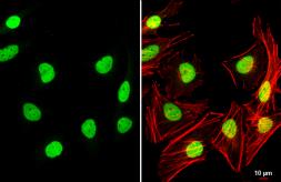 Anti-TEAD4 antibody used in Immunocytochemistry/ Immunofluorescence (ICC/IF). GTX108750