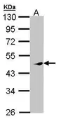 Anti-PRAK antibody [N1C2] used in Western Blot (WB). GTX108759