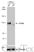 Anti-CD146 antibody [C1C3] used in Western Blot (WB). GTX108777
