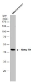 Anti-C17orf75 antibody [N1C1] used in Western Blot (WB). GTX108779