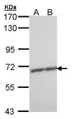 Anti-ZNF223 antibody [N1N3] used in Western Blot (WB). GTX108781