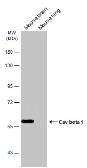 Anti-Cav beta 1 antibody [C1C3] used in Western Blot (WB). GTX108807