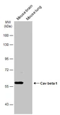 Anti-Cav beta 1 antibody [C1C3] used in Western Blot (WB). GTX108807