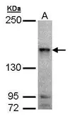 Anti-MAP4K6 antibody [C2C3-2], C-term used in Western Blot (WB). GTX108816