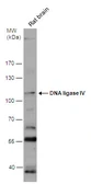 Anti-DNA ligase IV antibody used in Western Blot (WB). GTX108820