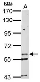 Anti-KCNG1 antibody used in Western Blot (WB). GTX108833