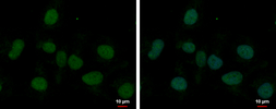 Anti-MED8 antibody used in Immunocytochemistry/ Immunofluorescence (ICC/IF). GTX108837