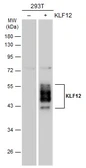 Anti-KLF12 antibody used in Western Blot (WB). GTX108840