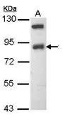 Anti-ENaC Beta antibody [N2C1], Internal used in Western Blot (WB). GTX108842