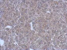 Anti-Bestrophin 1 antibody used in IHC (Paraffin sections) (IHC-P). GTX108854
