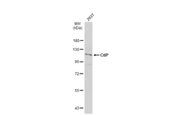 Anti-CtIP antibody [C1C3] used in Western Blot (WB). GTX108857