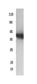 Human USP12 protein, His tag. GTX108859-pro