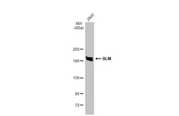 Anti-BLM antibody [N1N3] used in Western Blot (WB). GTX108868