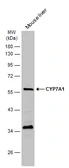 Anti-CYP7A1 antibody [N3C3] used in Western Blot (WB). GTX108871