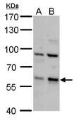 Anti-PCTAIRE2 antibody used in Western Blot (WB). GTX108880