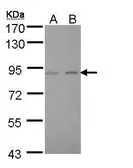 Anti-LIM kinase 2 antibody used in Western Blot (WB). GTX108903