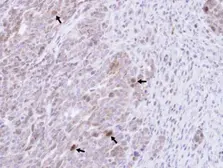 Anti-GRB14 antibody [N1C2] used in IHC (Paraffin sections) (IHC-P). GTX108911