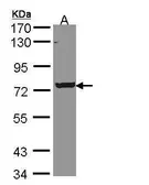 Anti-LOC169436 antibody used in Western Blot (WB). GTX108921