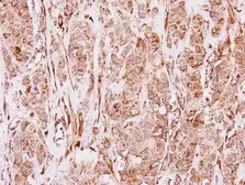 Anti-MMP19 antibody used in IHC (Paraffin sections) (IHC-P). GTX108931