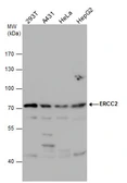 Anti-XPD antibody used in Western Blot (WB). GTX108948