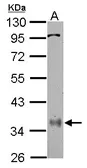 Anti-PPP6C antibody used in Western Blot (WB). GTX108968