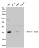 Anti-Creatine kinase (muscle) antibody [N2C3] used in Western Blot (WB). GTX108969