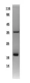 Human AGR3 protein, His tag. GTX108985-pro