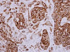 Anti-AGR3 antibody [N1C3-2] used in IHC (Paraffin sections) (IHC-P). GTX108985