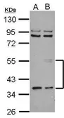 Anti-ANGPTL3 antibody used in Western Blot (WB). GTX108986
