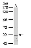 Anti-SNTB2 antibody [N2C3-2] used in Western Blot (WB). GTX108987