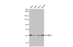 Anti-DKC1 antibody used in Western Blot (WB). GTX109000
